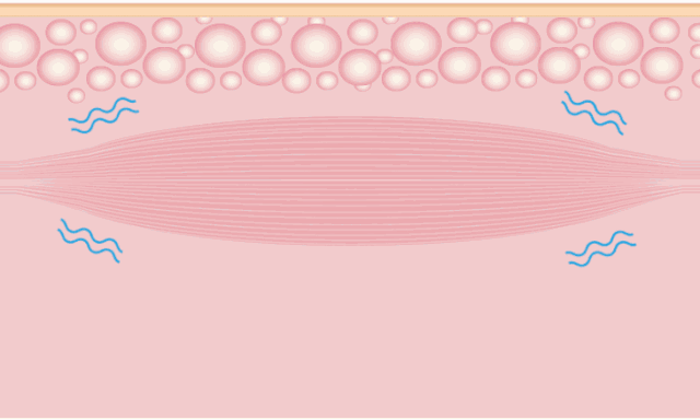1755095476588915.gif